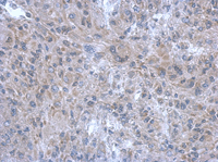 Immunohistochemistry (Formalin/PFA-fixed paraffin-embedded sections) - Anti-FBXL17 antibody (AB111683), expandable thumbnail