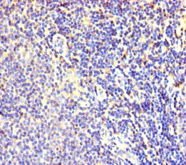 Immunohistochemistry (Formalin/PFA-fixed paraffin-embedded sections) - Anti-FBXL18 antibody (AB239066)