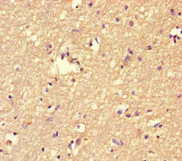 Immunohistochemistry (Formalin/PFA-fixed paraffin-embedded sections) - Anti-FBXL18 antibody (AB239066)