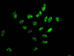 Immunocytochemistry/ Immunofluorescence - Anti-FBXL19 antibody [EPR11957] - BSA and Azide free (AB249735)