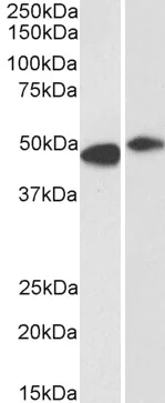 Western blot - Anti-FBXL2 antibody (AB17018)