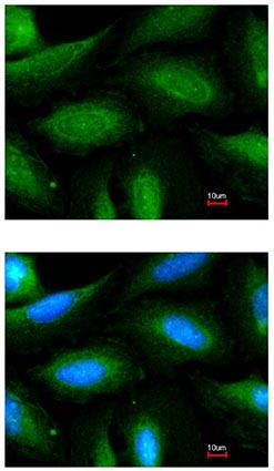 Immunocytochemistry/ Immunofluorescence - Anti-FBXL2 antibody - N-terminal (AB153842)