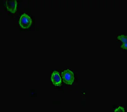 Immunocytochemistry/ Immunofluorescence - Anti-FBXL21/FBL3 antibody (AB222894)