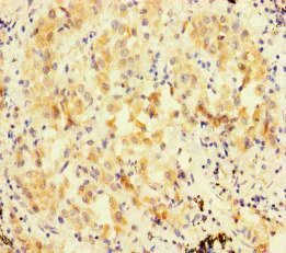 Immunohistochemistry (Formalin/PFA-fixed paraffin-embedded sections) - Anti-FBXL21/FBL3 antibody (AB222894)