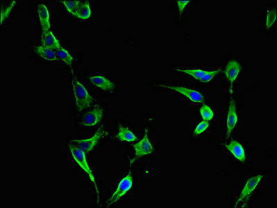 Immunocytochemistry/ Immunofluorescence - Anti-FBXL22 antibody (AB223059), expandable thumbnail