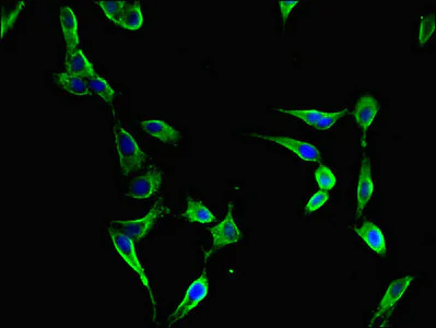 Immunocytochemistry/ Immunofluorescence - Anti-FBXL22 antibody (AB223059)