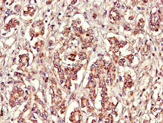 Immunohistochemistry (Formalin/PFA-fixed paraffin-embedded sections) - Anti-FBXL22 antibody (AB223059), expandable thumbnail