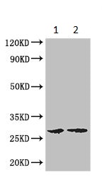 Western blot - Anti-FBXL22 antibody (AB223059), expandable thumbnail