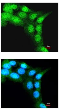 Immunocytochemistry/ Immunofluorescence - Anti-FBXL3 antibody (AB96645)