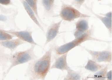Immunocytochemistry - Anti-FBXO11 antibody (AB181801)