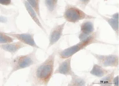 Immunocytochemistry - Anti-FBXO11 antibody (AB181801)