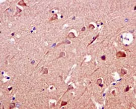Immunohistochemistry (Formalin/PFA-fixed paraffin-embedded sections) - Anti-FBXO21 antibody [EPR13163] - BSA and Azide free (AB250120)
