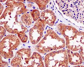 Immunohistochemistry (Formalin/PFA-fixed paraffin-embedded sections) - Anti-FBXO21 antibody [EPR13163] - BSA and Azide free (AB250120)