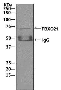 Immunoprecipitation - Anti-FBXO21 antibody [EPR13163] - BSA and Azide free (AB250120)