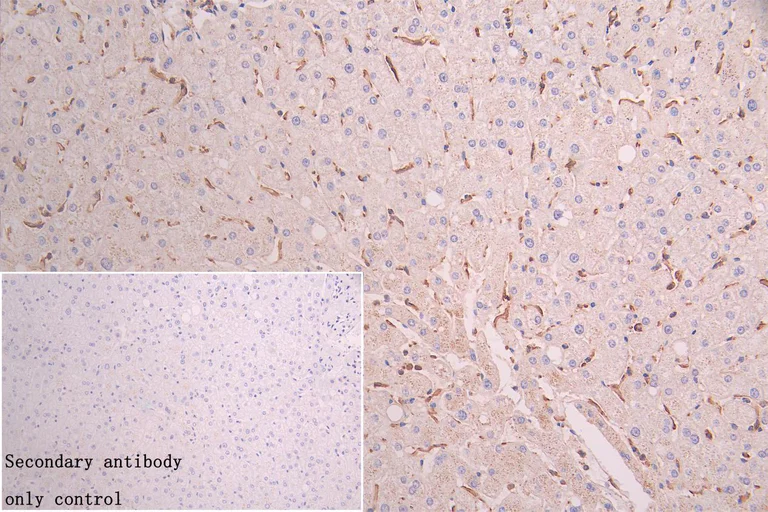 Immunohistochemistry (Formalin/PFA-fixed paraffin-embedded sections) - Anti-FBXO22 antibody (AB230395)