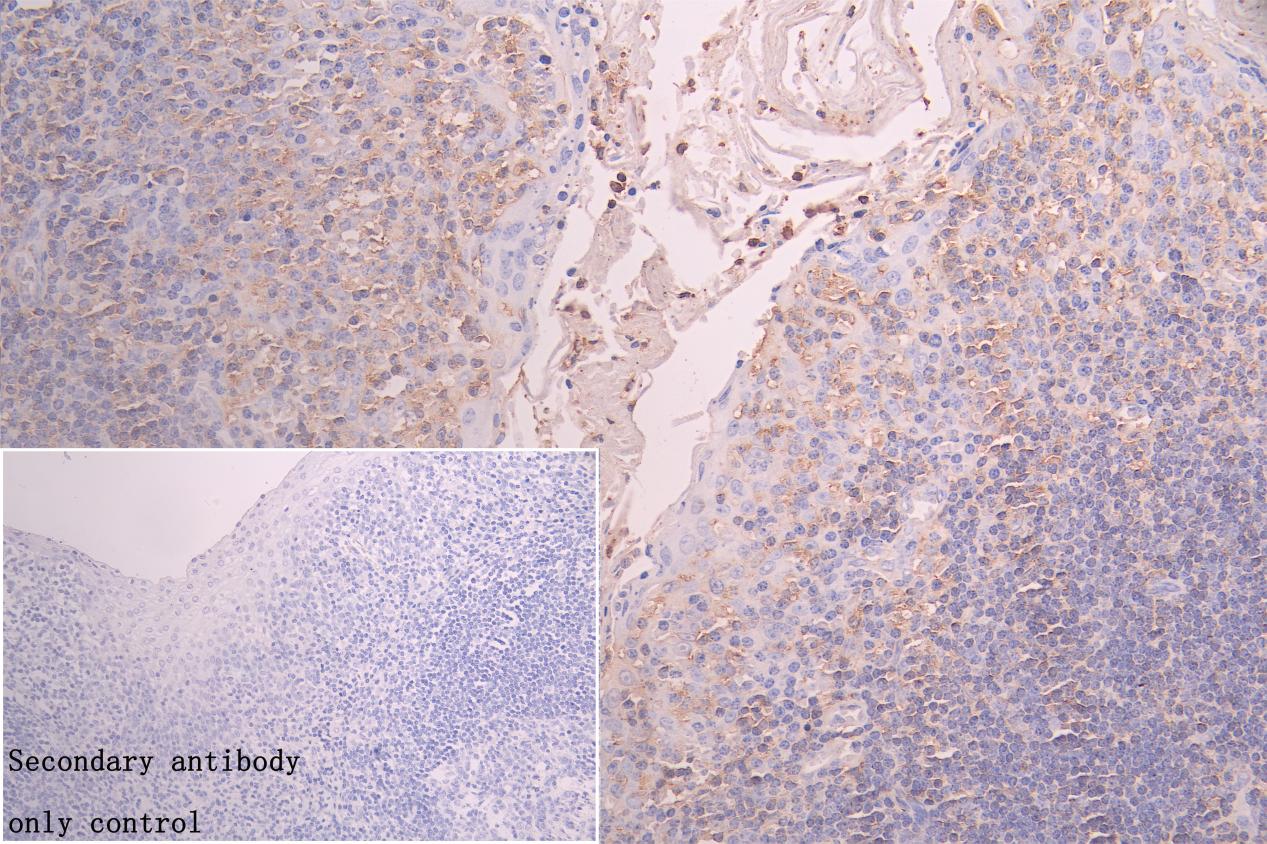 Immunohistochemistry (Formalin/PFA-fixed paraffin-embedded sections) - Anti-FBXO22 antibody (AB230395)