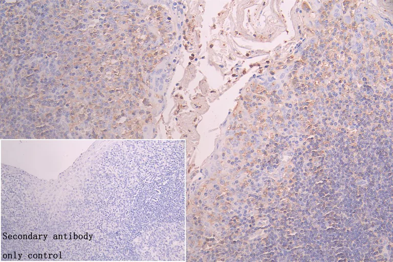 Immunohistochemistry (Formalin/PFA-fixed paraffin-embedded sections) - Anti-FBXO22 antibody (AB230395)