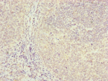 Immunohistochemistry (Formalin/PFA-fixed paraffin-embedded sections) - Anti-FBXO22 antibody (AB230395)