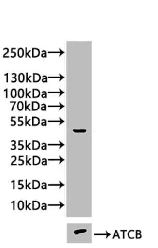 Western blot - Anti-FBXO22 antibody (AB230395)