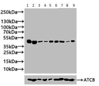 Western blot - Anti-FBXO22 antibody (AB230395)