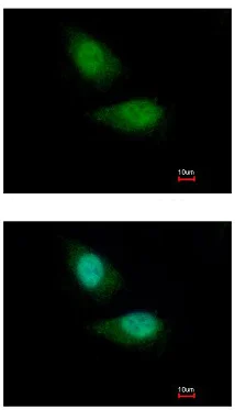 Immunocytochemistry/ Immunofluorescence - Anti-FBXO28 antibody (AB154068)