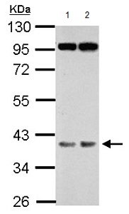Western blot - Anti-FBXO28 antibody (AB154068)