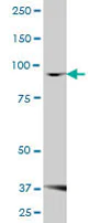 Western blot - Anti-FBXO30 antibody (AB68224)