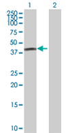 Western blot - Anti-FBXO31 antibody (AB68067)