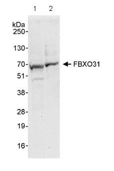 Western blot - Anti-FBXO31 antibody (AB86137)