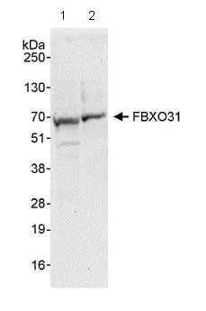 Western blot - Anti-FBXO31 antibody (AB86137)