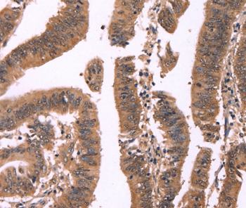 Immunohistochemistry (Formalin/PFA-fixed paraffin-embedded sections) - Anti-FBXO31 antibody - C-terminal (AB198865)