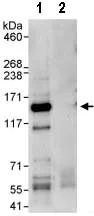 Immunoprecipitation - Anti-FBXO38 antibody (AB87729)