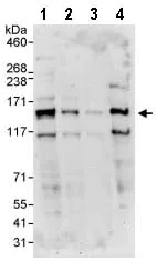 Western blot - Anti-FBXO38 antibody (AB87729)