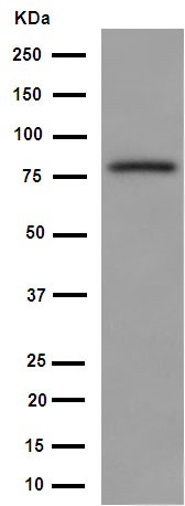 Western blot - Anti-FBXO40 antibody [EPR15005] (AB190688), expandable thumbnail