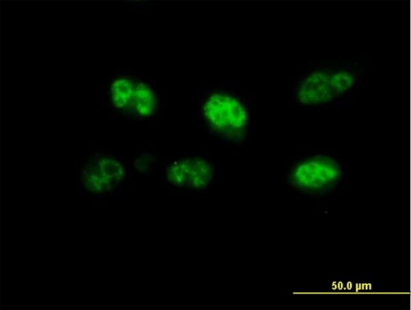 Immunocytochemistry/ Immunofluorescence - Anti-FBXO7 antibody (AB167278), expandable thumbnail