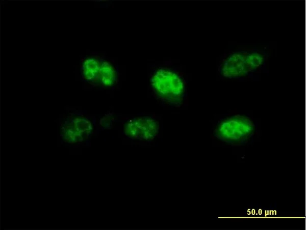 Immunocytochemistry/ Immunofluorescence - Anti-FBXO7 antibody (AB167278)