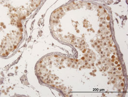 Immunohistochemistry (Formalin/PFA-fixed paraffin-embedded sections) - Anti-FBXO7 antibody (AB167278), expandable thumbnail