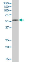 Western blot - Anti-FBXO7 antibody (AB167278)