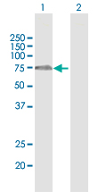 Western blot - Anti-FBXO7 antibody (AB167278), expandable thumbnail