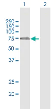 Western blot - Anti-FBXO7 antibody (AB167278)