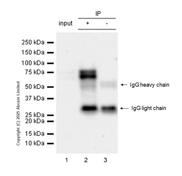 Immunoprecipitation - Anti-FBXO7 antibody [EPR29658-670] (AB324143), expandable thumbnail