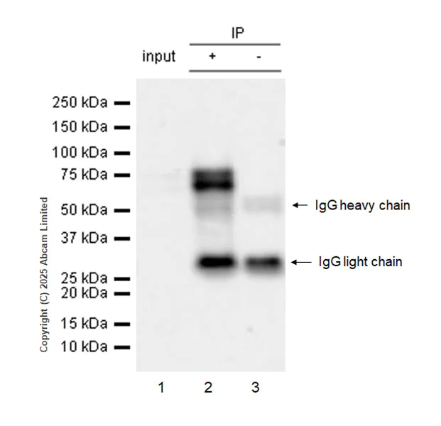 Immunoprecipitation - Anti-FBXO7 antibody [EPR29658-670] (AB324143)