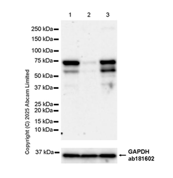 Western blot - Anti-FBXO7 antibody [EPR29658-670] (AB324143), expandable thumbnail
