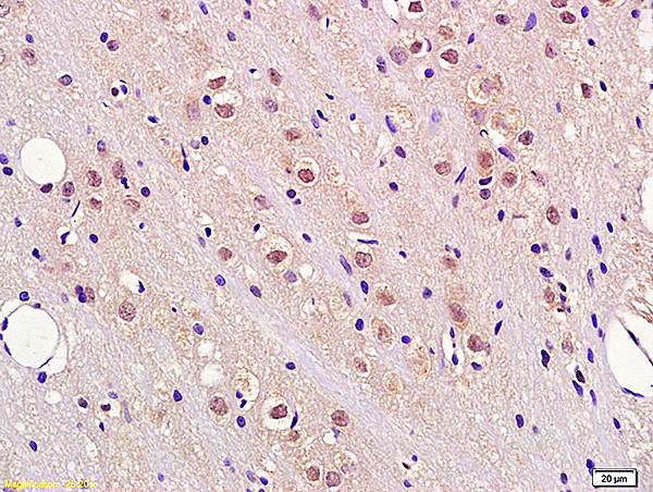 Immunohistochemistry (Formalin/PFA-fixed paraffin-embedded sections) - Anti-Fbxw7 Antibody (AB317368)