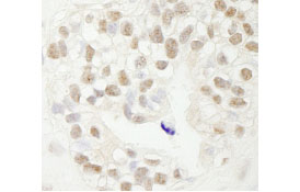 Immunohistochemistry (Formalin/PFA-fixed paraffin-embedded sections) - Anti-Fbxw7 antibody (AB84783)