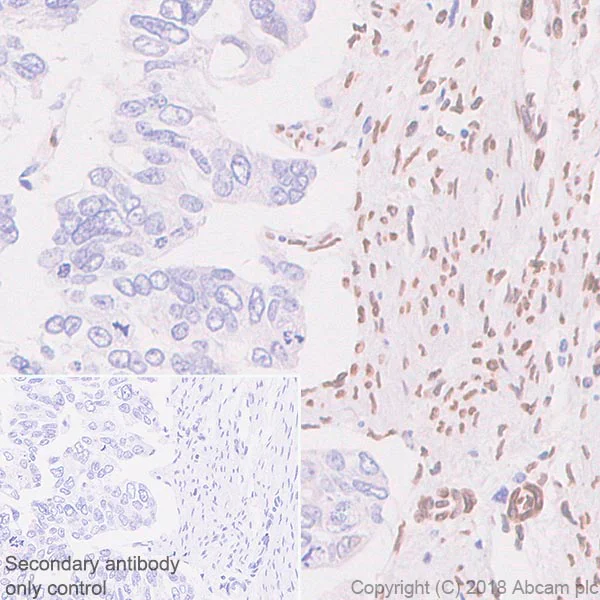 Immunohistochemistry (Formalin/PFA-fixed paraffin-embedded sections) - Anti-Fbxw7 antibody [SP237] - BSA and Azide free (AB246353)