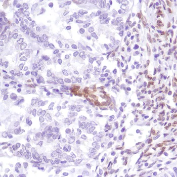 Immunohistochemistry (Formalin/PFA-fixed paraffin-embedded sections) - Anti-Fbxw7 antibody [SP237] - BSA and Azide free (AB246353)