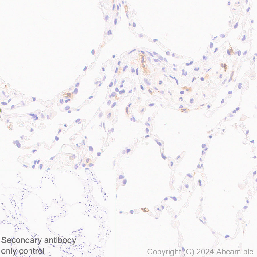 Immunohistochemistry (Formalin/PFA-fixed paraffin-embedded sections) - Anti-Fc epsilon RI/FCER1A antibody [EPR28402-78] (AB316199), expandable thumbnail