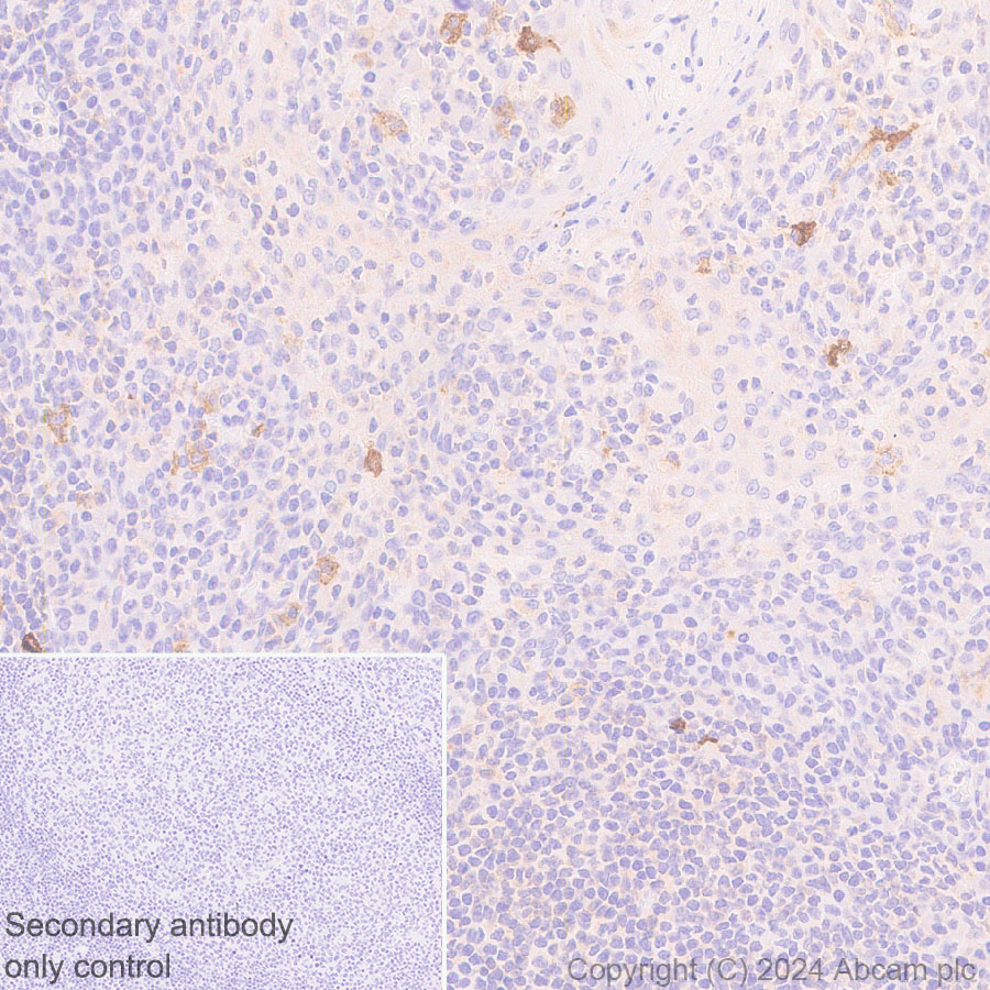 Immunohistochemistry (Formalin/PFA-fixed paraffin-embedded sections) - Anti-Fc epsilon RI/FCER1A antibody [EPR28402-78] (AB316199), expandable thumbnail