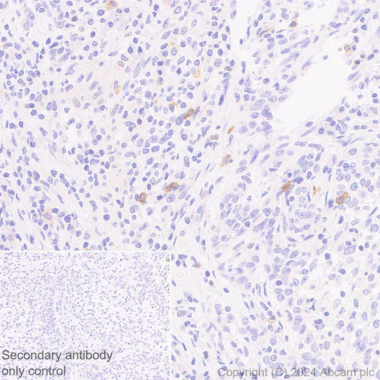Immunohistochemistry (Formalin/PFA-fixed paraffin-embedded sections) - Anti-Fc epsilon RI/FCER1A antibody [EPR28402-78] (AB316199)